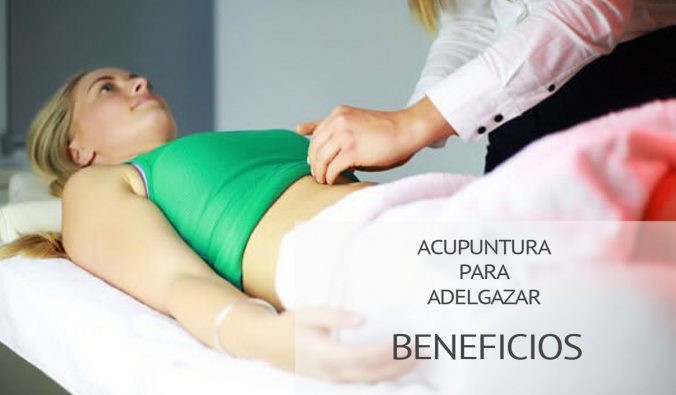 acupuntura-para-adelgazar